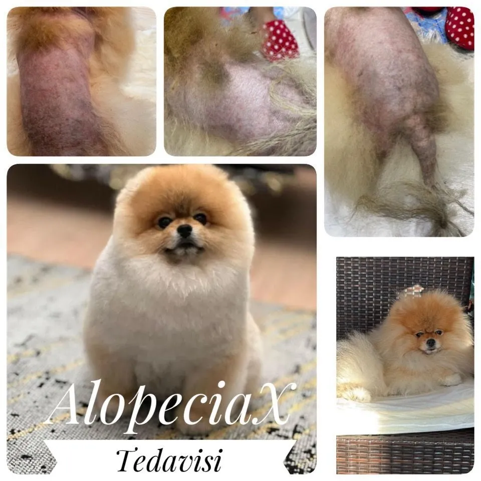 Alopecia Tedavisi